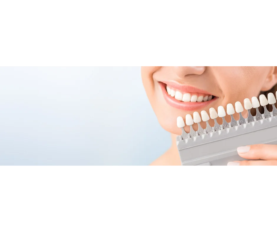 Teeth whitening
